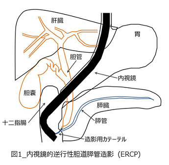 ERCP01