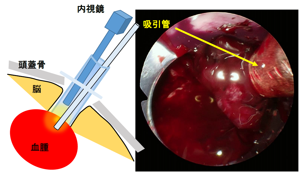 Neurosurgery_02