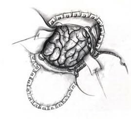 Neurosurgery_03