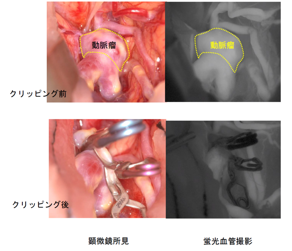 Neurosurgery_04