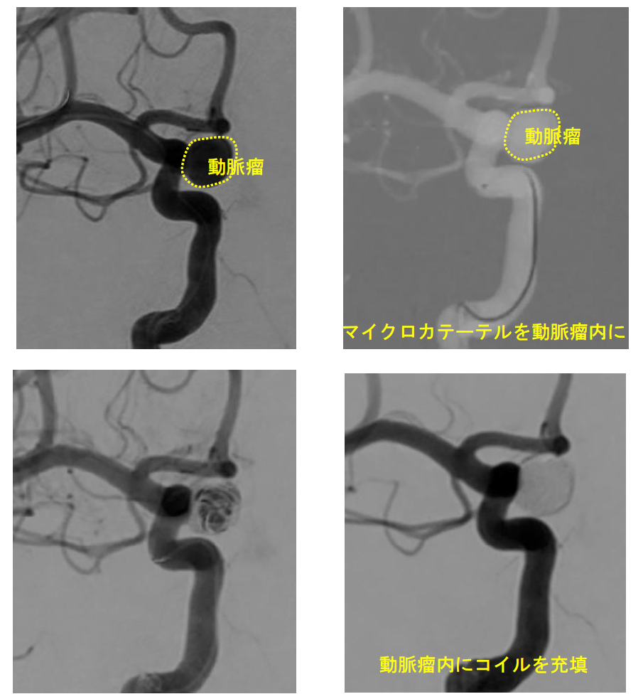 Neurosurgery_05