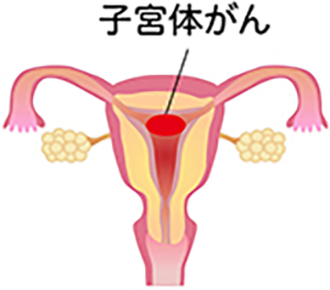 子宮の図